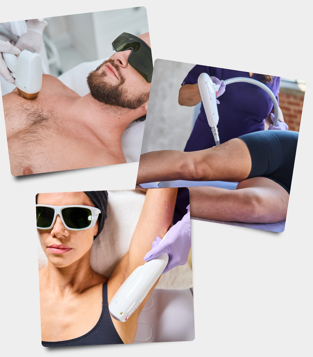 30-Off-Laser-Hair-Removal
